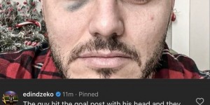 【龙八国际】哲科回应伊卡尔迪淤青照：撞门柱然后社媒要点球，不愧是他们