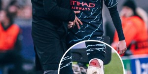 【龙八国际】B席被铲伤离场，球袜破洞&脚部流血?