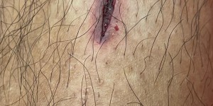 【龙八国际】腿上被踹开了深口子，吕文君：兄弟们好样的！我得先养养！ ​​​