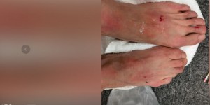 <?php the_title(); ?>