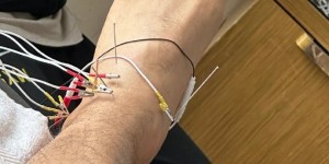 【龙八国际】李磊社媒晒治伤照：有时也不知在坚持什么，可路就是这样走过来的