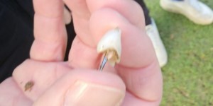 【龙八国际】拼！普利茅斯中卫尼克拉-卡蒂奇获评全场最佳，本场被撞掉一颗牙