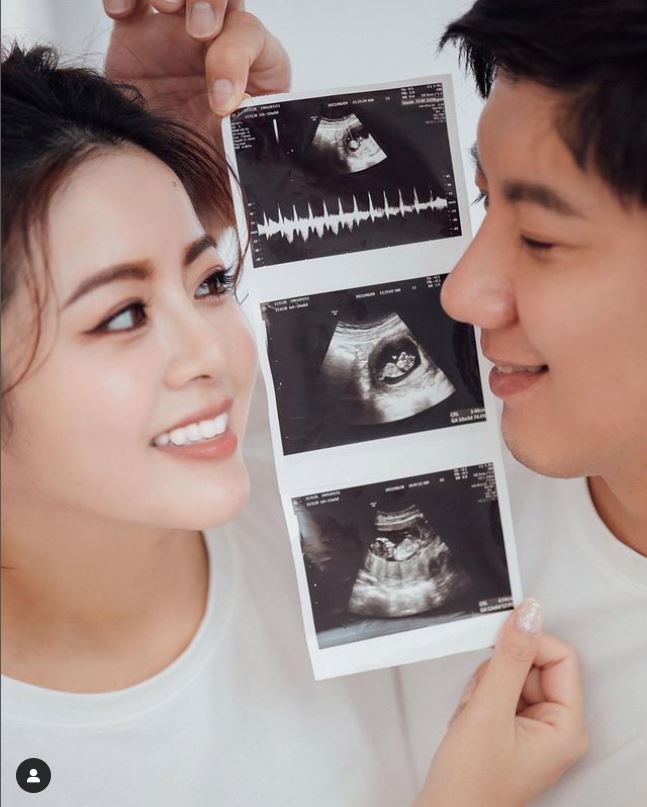 网红双胞胎姊妹同时怀孕惊:很少见6年做试管3次终圆梦