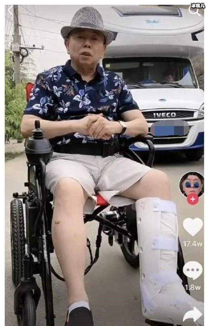 潘长江因拍戏左脚骨折，最关心的却是戏该怎么拍，表示工作不能停