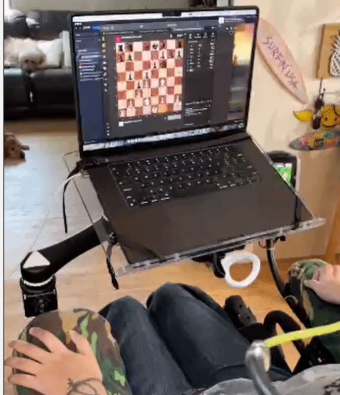 心灵感应!马斯克脑机接口实验最新进展:意念畅玩国际象棋