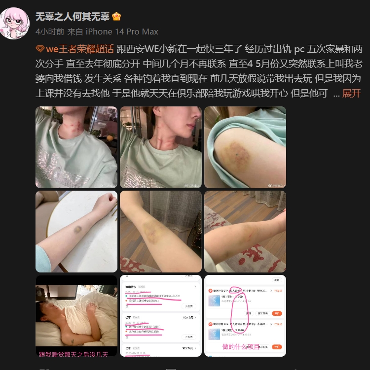 震惊西安第一拳!WE王者教练小新被锤:多次家暴 吃软饭还出轨+天价PC